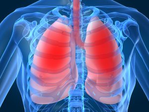 Акція «Дні профілактики туберкульозу та хронічних захворювань органів дихання у населення»